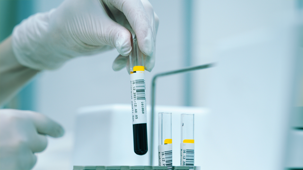 Das Bild zeigt eine Person im Labor, die Reagenzgläser sortiert, in denen eine dunkle Flüssigkeit enthalten ist. 